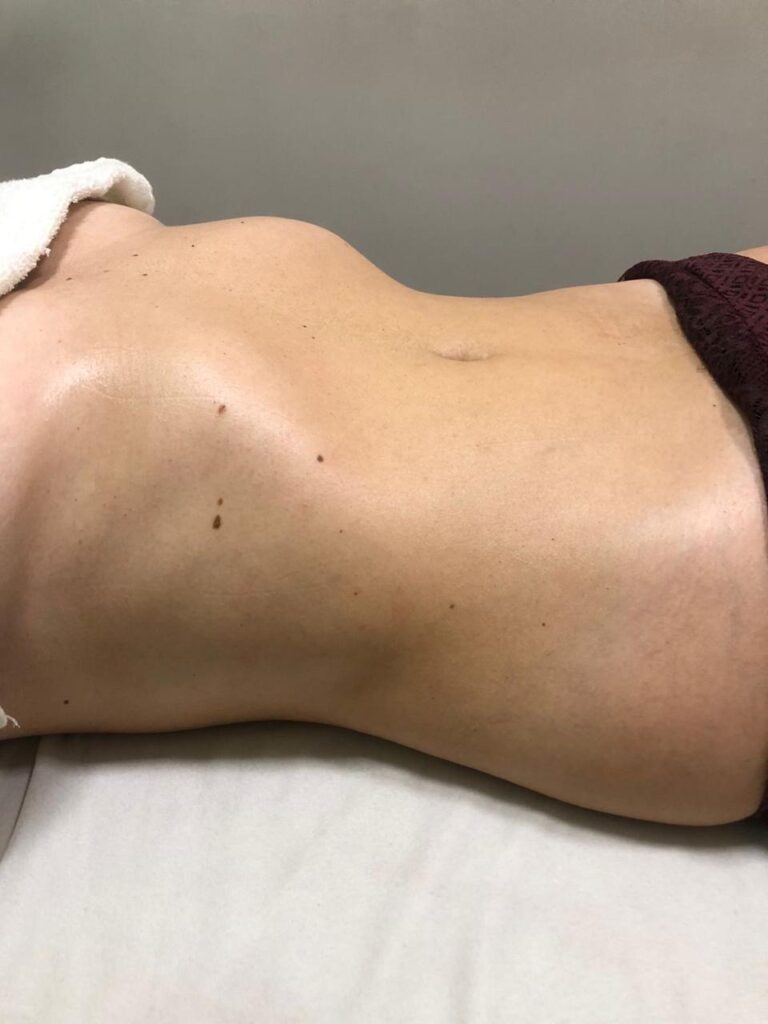 Drenagem Linfática Facial · Andrezza Vilar Clinic — estetica em Funcionários, Belo Horizonte - MG