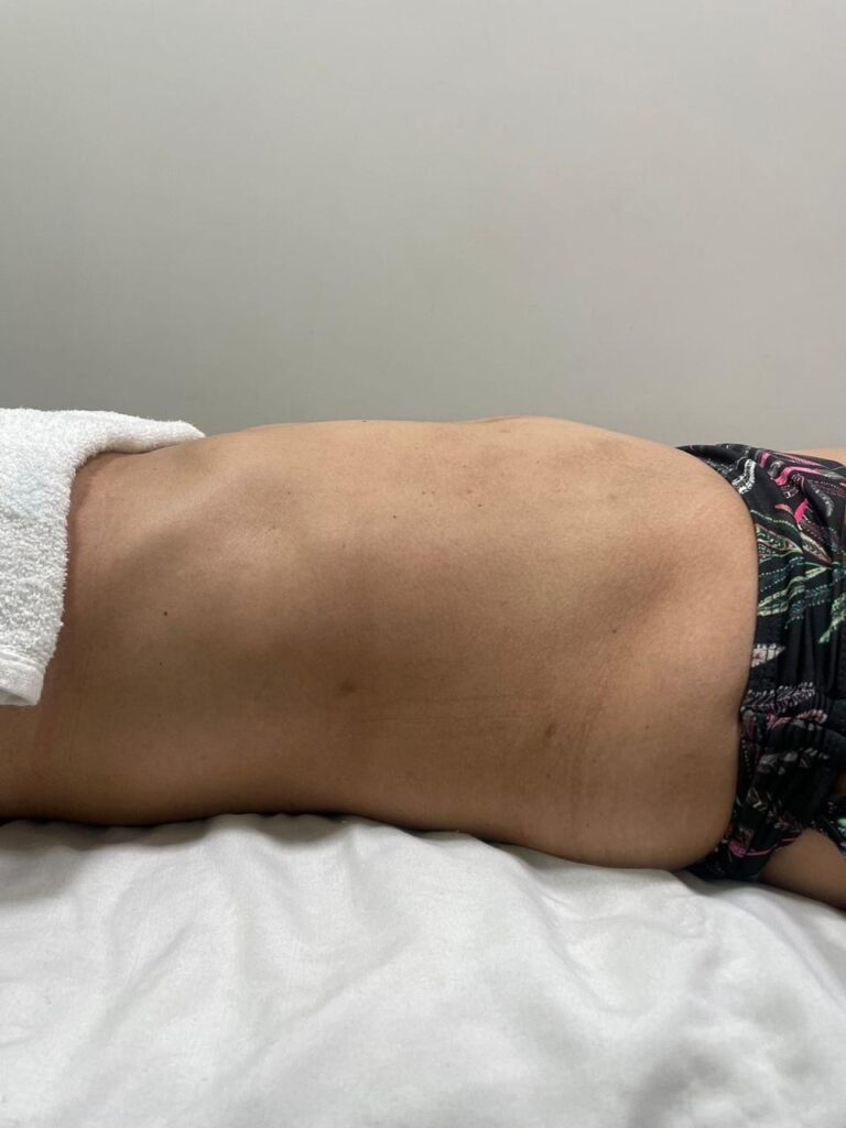 Drenagem Linfática Facial · Andrezza Vilar Clinic — estetica em Funcionários, Belo Horizonte - MG